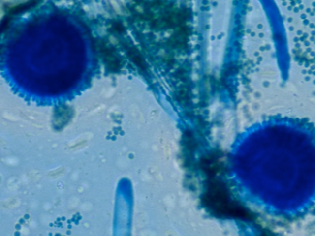 Aspergillus flavus