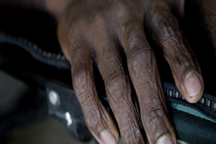 A cholera-infected patient lays on a bed at the hospital in L'Estere, 20 km north of Saint Marc, Haiti.