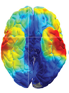 multicolored brain picture