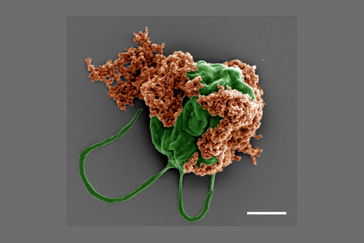 Colored SEM image of a microrobot made of an algae cell (green) covered with drug-filled nanoparticles (orange) coated with red blood cell membranes. Scale bar: 2 µm. Credit: Zhengxing Li