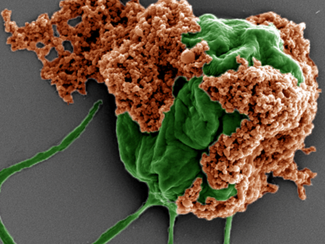 Colored SEM image of a microrobot made of an algae cell (green) covered with drug-filled nanoparticles (orange) coated with red blood cell membranes. Scale bar: 2 µm. Credit: Zhengxing Li