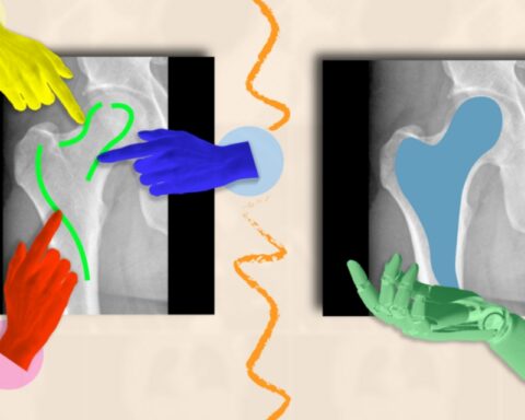 AI framework that can efficiently highlight anatomical structures across different medical scans, assisting medical workers to delineate regions of interest and abnormalities.