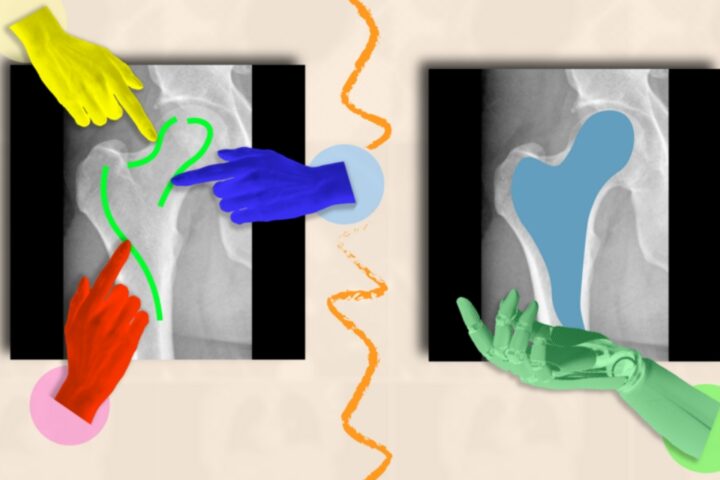 AI framework that can efficiently highlight anatomical structures across different medical scans, assisting medical workers to delineate regions of interest and abnormalities.