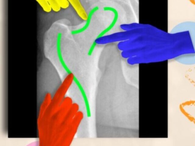 AI framework that can efficiently highlight anatomical structures across different medical scans, assisting medical workers to delineate regions of interest and abnormalities.