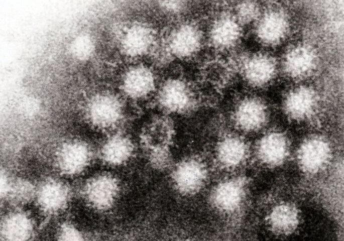 Representative Image. Norovirus particles. Photo Source: Graham Beards (CC BY-SA 2.0)