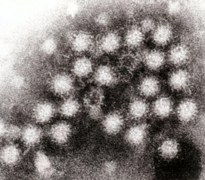 Representative Image. Norovirus particles. Photo Source: Graham Beards (CC BY-SA 2.0)