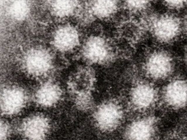 Norovirus Cases Spike Wisconsin at 19%, Nationwide Up 36% (1)