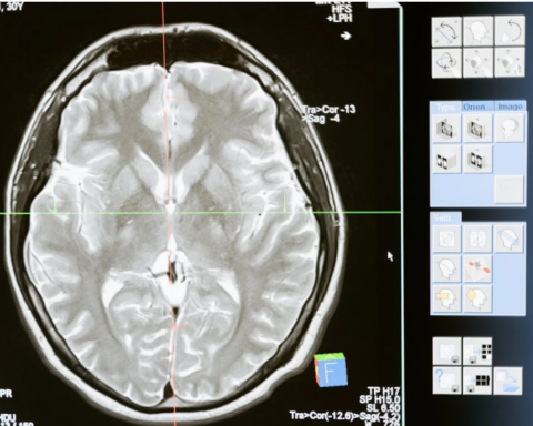 Representative Image. Brain Scan. Photo Source: MART PRODUCTION (Pexels)