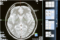 Representative Image. Brain Scan. Photo Source: MART PRODUCTION (Pexels)