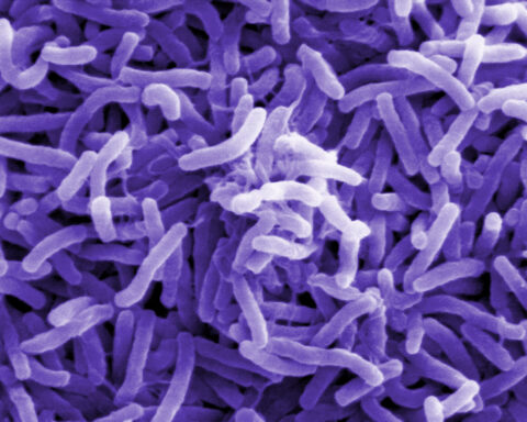 Representative Image. Scanning electron microscope image of Vibrio cholerae bacteria, which infect the digestive system