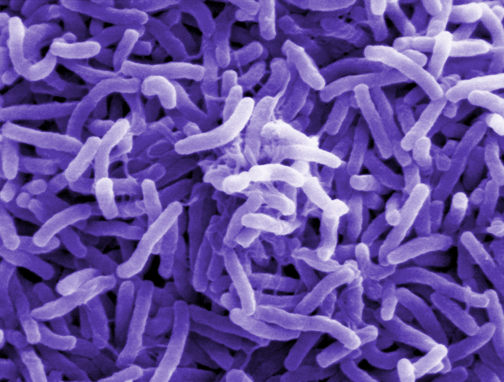 Representative Image. Scanning electron microscope image of Vibrio cholerae bacteria, which infect the digestive system