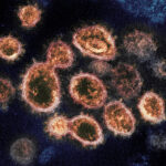 Representative image of Novel Coronavirus SARS-CoV-2, Photo Source: NIH Image gallery (PDM 1.0)