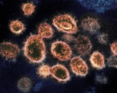 Representative image of Novel Coronavirus SARS-CoV-2, Photo Source: NIH Image gallery (PDM 1.0)