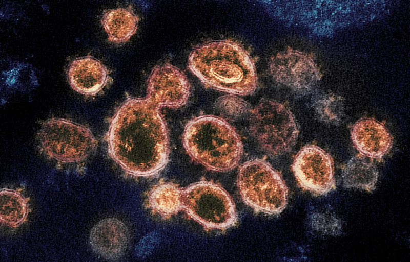 Representative image of Novel Coronavirus SARS-CoV-2, Photo Source: NIH Image gallery (PDM 1.0)