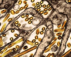 Representative Image. Colorized transmission electron micrograph of avian influenza A H5N1 virus particles (yellow) grown in Madin-Darby Canine Kidney (MDCK) epithelial cells. Microscopy by CDC; repositioned and recolored by NIAID.