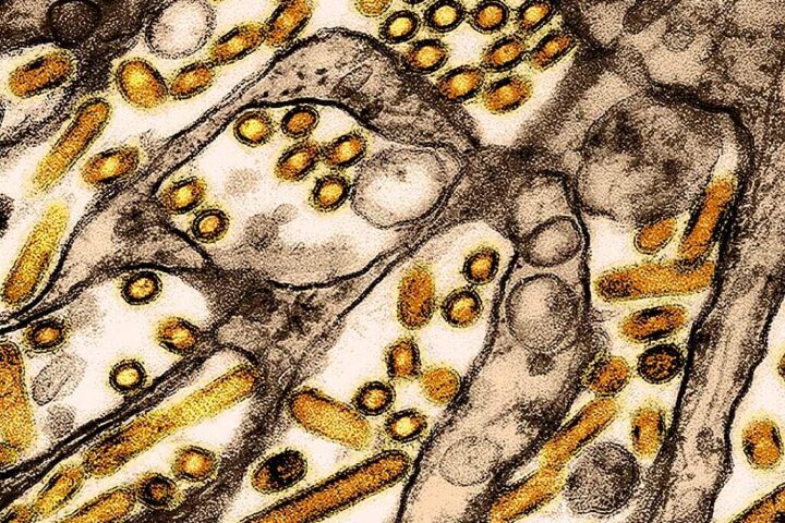 Representative Image. Colorized transmission electron micrograph of avian influenza A H5N1 virus particles (yellow) grown in Madin-Darby Canine Kidney (MDCK) epithelial cells. Microscopy by CDC; repositioned and recolored by NIAID.