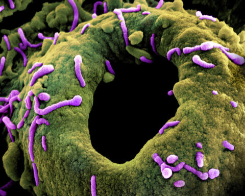 Marburg Virus Particles , Photo Source: NIAID (CC BY 2.0)