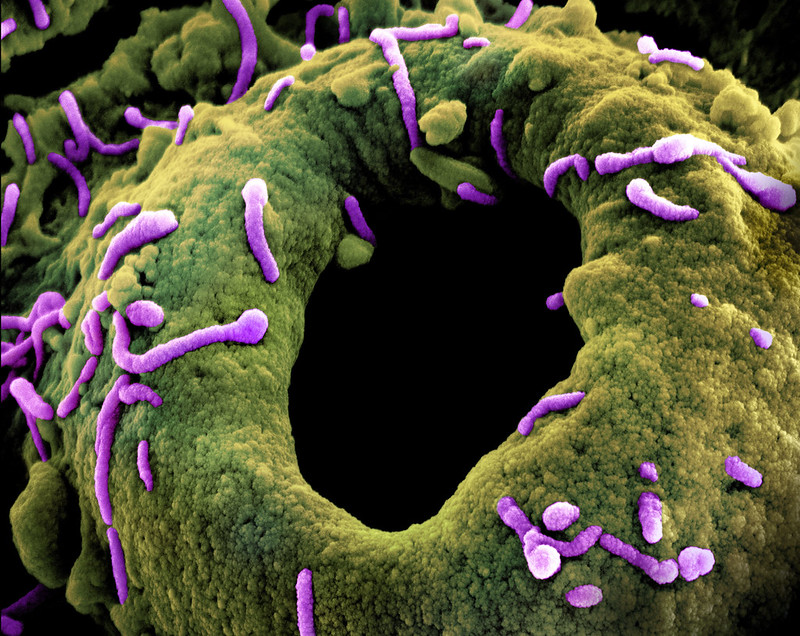 Marburg Virus Particles , Photo Source: NIAID (CC BY 2.0)