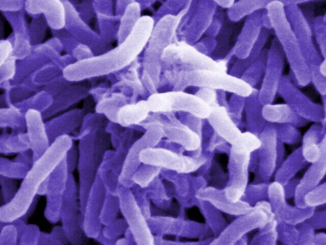 Scanning electron microscope image of Vibrio cholerae bacteria, which infect the digestive system