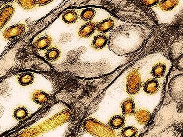 Representative Image. Colorized transmission electron micrograph of avian influenza A H5N1 virus particles (yellow) grown in Madin-Darby Canine Kidney (MDCK) epithelial cells. Microscopy by CDC; repositioned and recolored by NIAID.