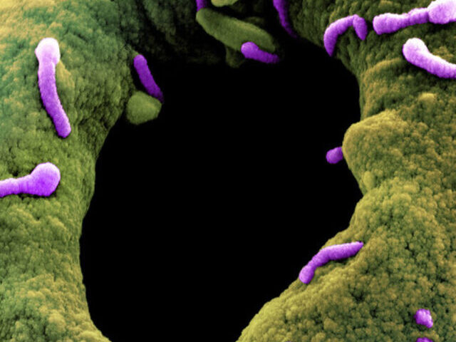 Marburg Virus Particles , Photo Source: NIAID (CC BY 2.0)