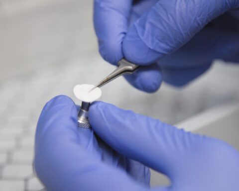 Representative image, Gloved hands carefully handle a small, white sample with tweezers. Photo Source: (hsc.unm.edu/news)