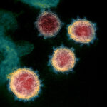 Representative image Novel Coronavirus SARS-CoV-2. Photo Source: NIAID (CC BY 2.0) (Flickr).