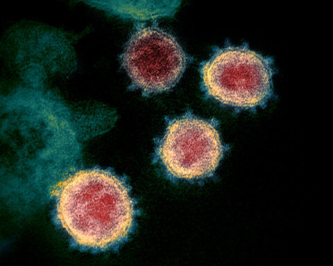 Representative image Novel Coronavirus SARS-CoV-2. Photo Source: NIAID (CC BY 2.0) (Flickr).