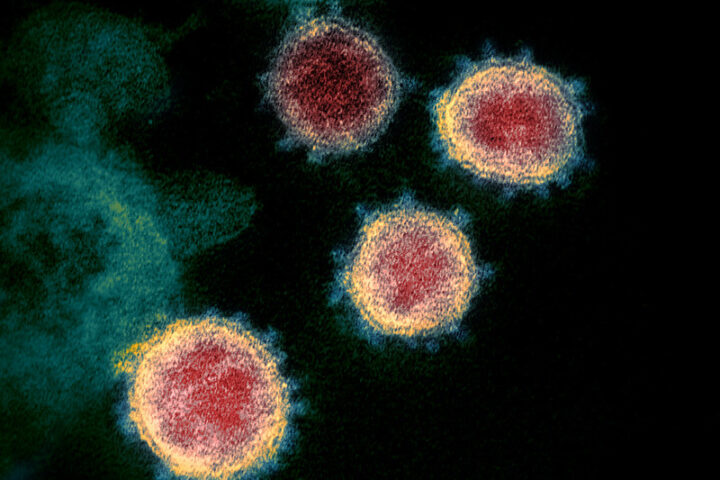 Representative image, Novel Coronavirus SARS-CoV-2. Photo Source: NIAID (CC BY 2.0)