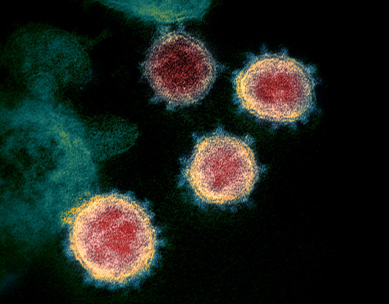 Representative image Novel Coronavirus SARS-CoV-2. Photo Source: NIAID (CC BY 2.0) (Flickr).