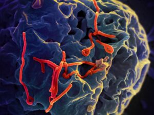 Representative Image: Ebola Virus.