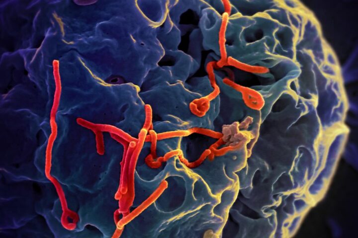 Representative Image: Ebola Virus.