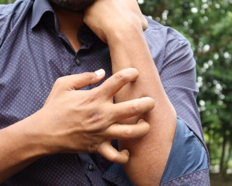 Man Scratching a Hand Photo Source:Towfiqu barbhuiya (Pexels)