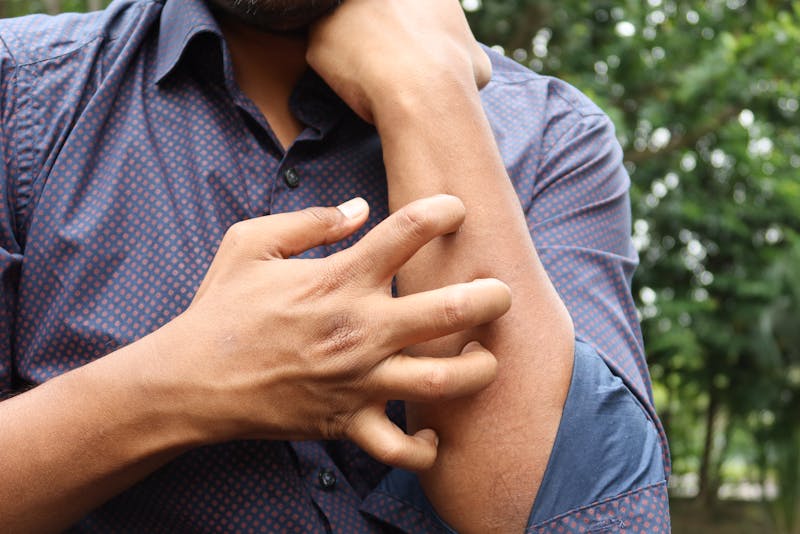 Man Scratching a Hand Photo Source:Towfiqu barbhuiya (Pexels)