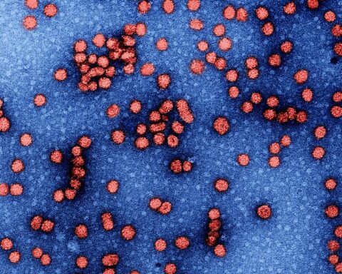 Representative Image. Hepatitis B Virus. Photo Source: NIAID (CC BY 2.0)