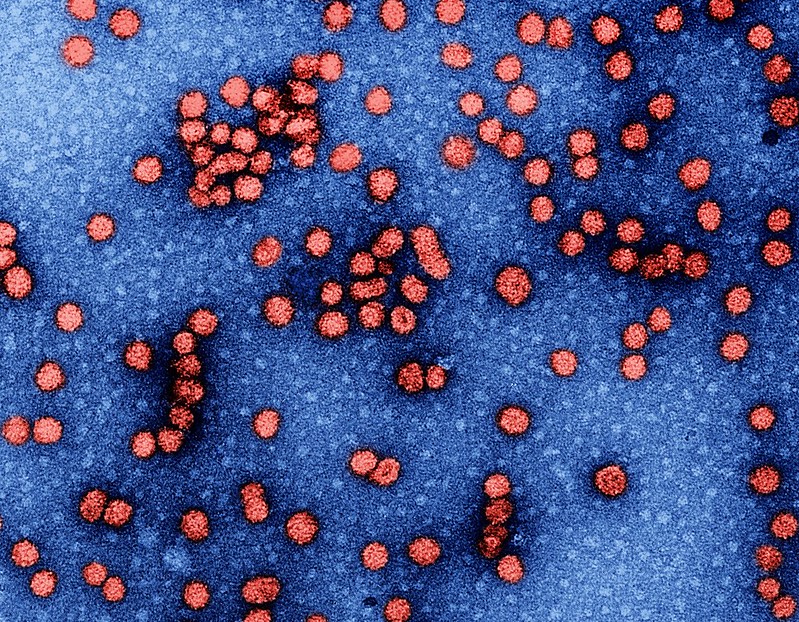 Representative Image. Hepatitis B Virus. Photo Source: NIAID (CC BY 2.0)